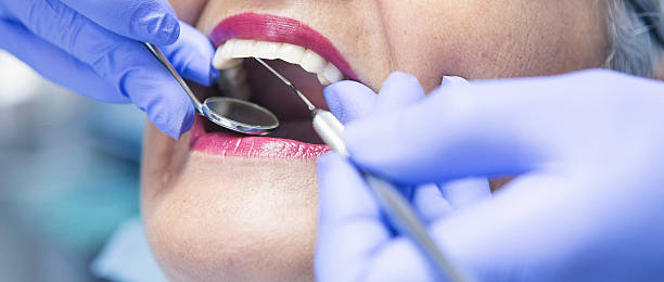 Best Emergency Treatment for Toothache in Marion, OH